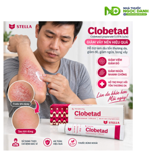 Kem Clobetad 0,05% 15g – Clobetasol Propionate Giảm Viêm, Ngứa Trong Các Bệnh Da Đáp Ứng Corticoid